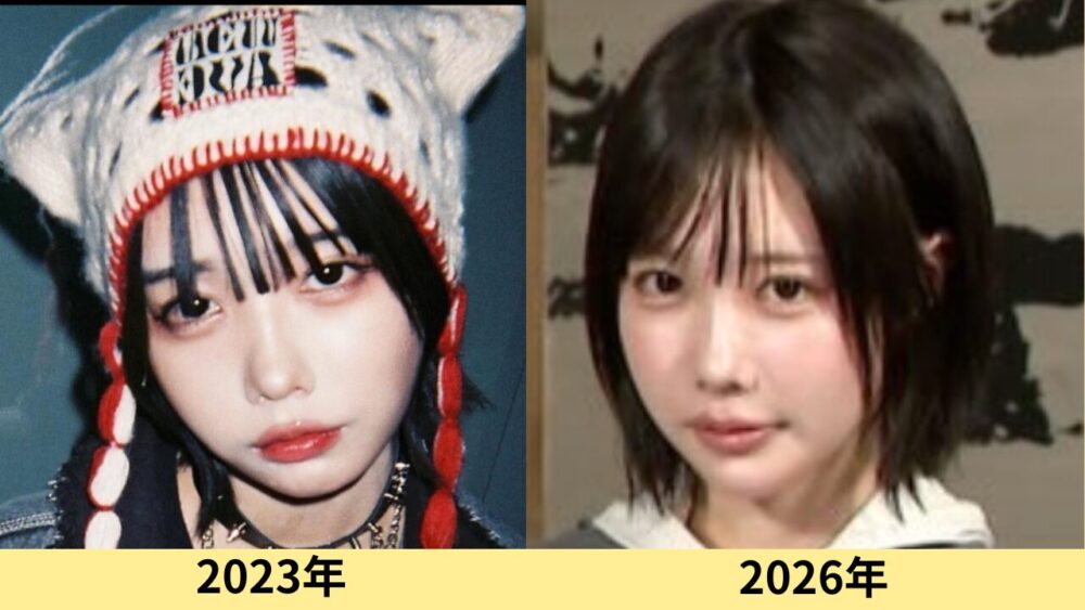 あのちゃん　顔変わった