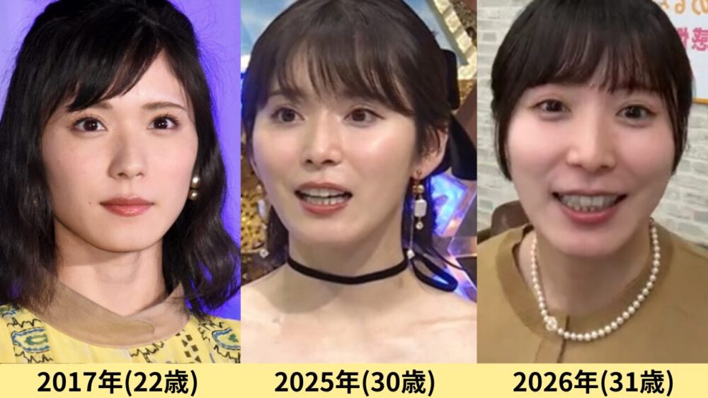 松岡茉優顔変わった
