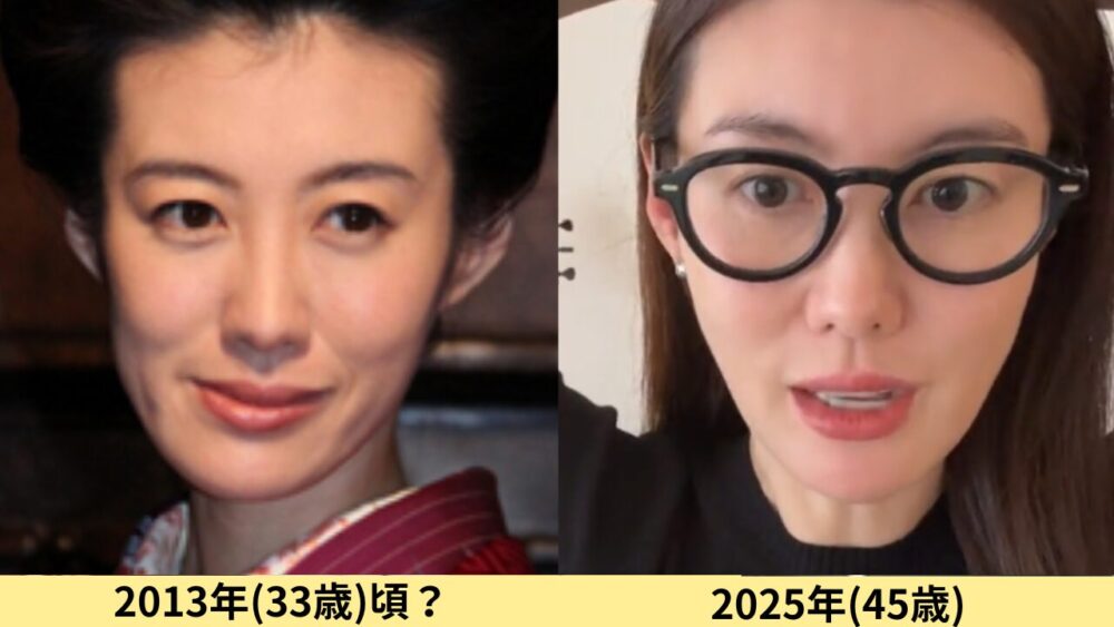 ともさかりえ顔変わった
