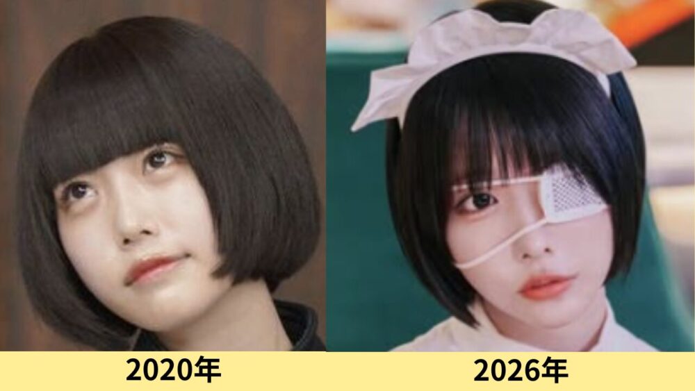 あのちゃん　顔変わった