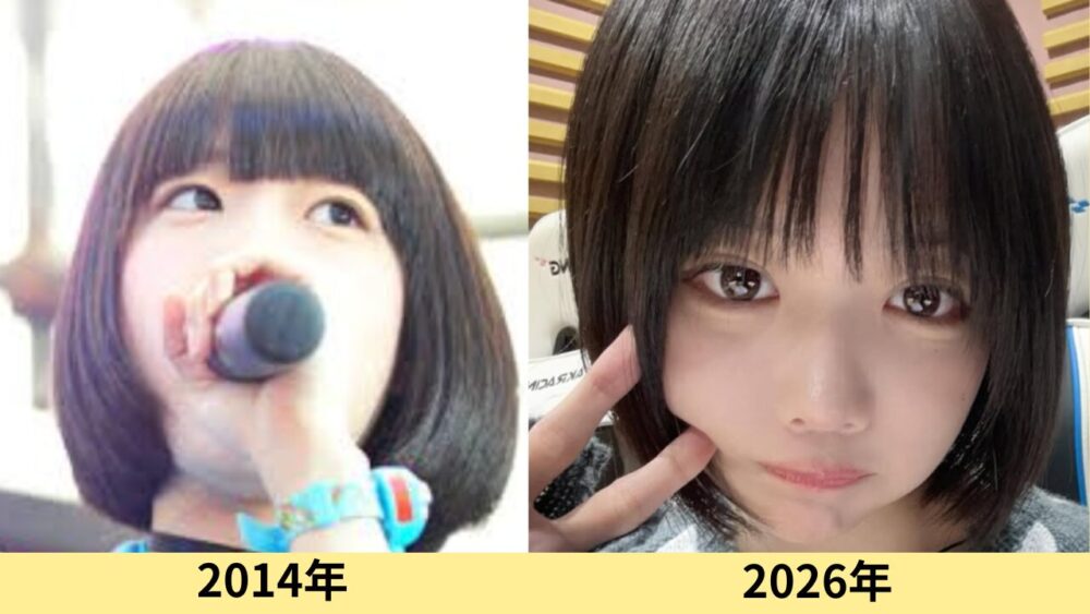 あのちゃん　顔変わった