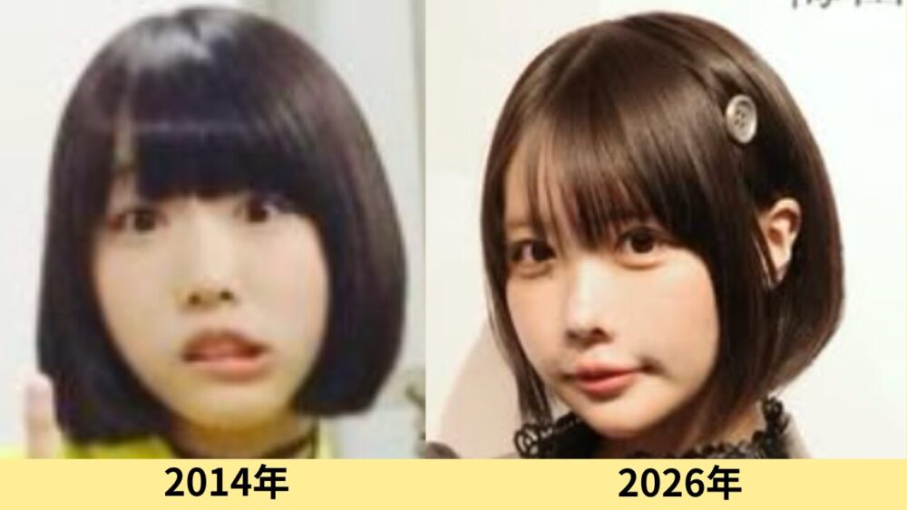あのちゃん　顔変わった