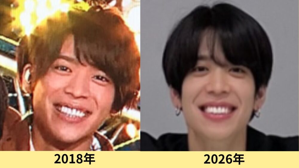 松島聡　顔変わった