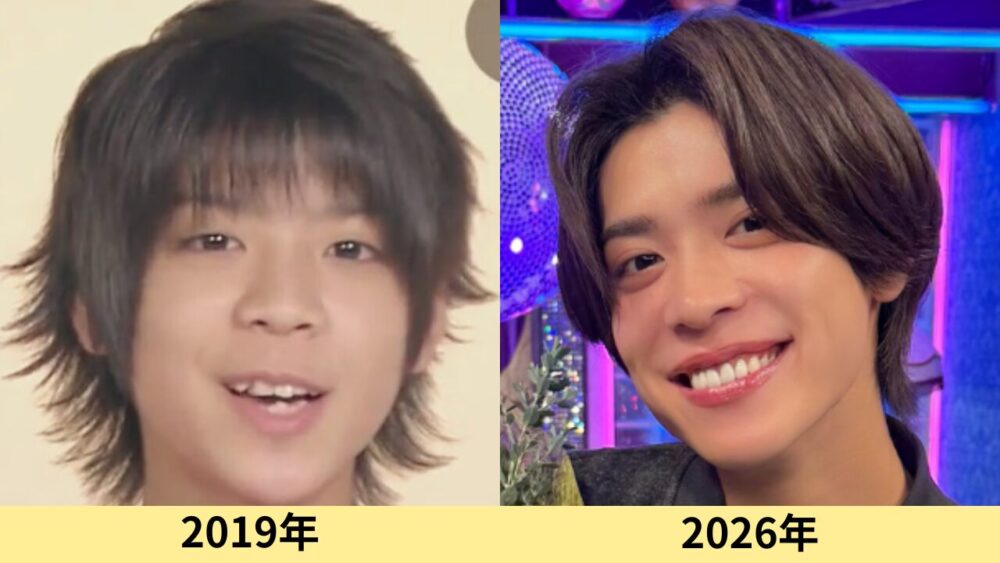 松島聡　顔変わった