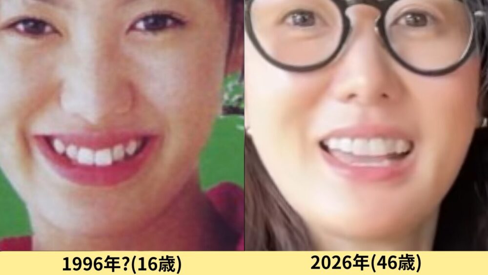 ともさかりえ顔変わった