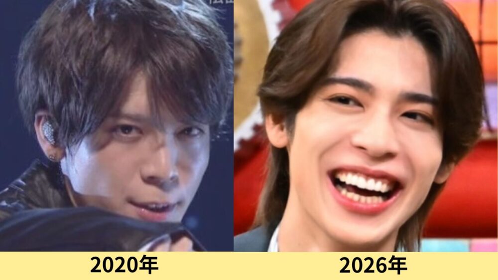 松島聡　顔変わった