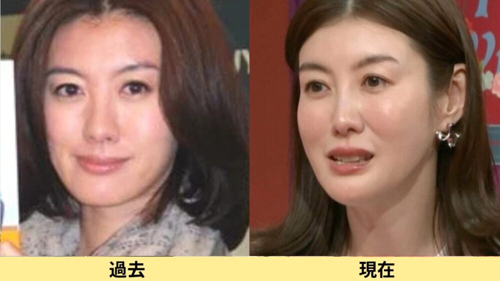 ともさかりえ顔変わった