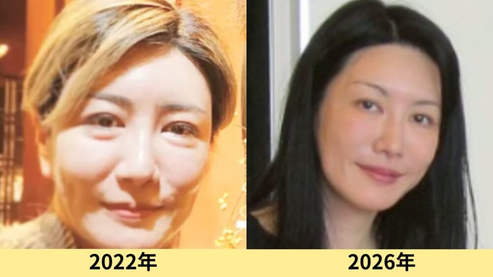 中野信子　顔変わった