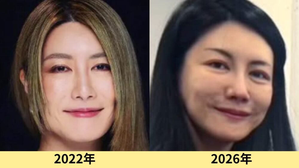中野信子　顔変わった