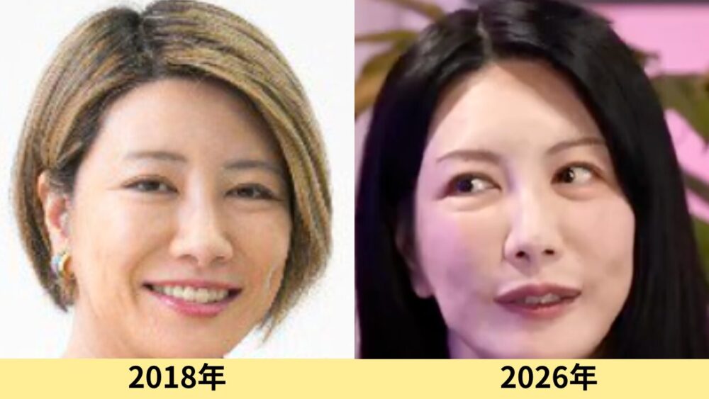 中野信子　顔変わった