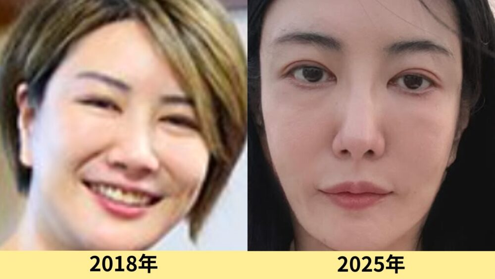 中野信子　顔変わった