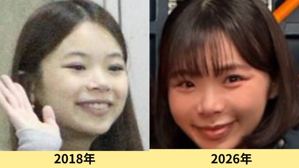 趣里　顔ふっくらした？