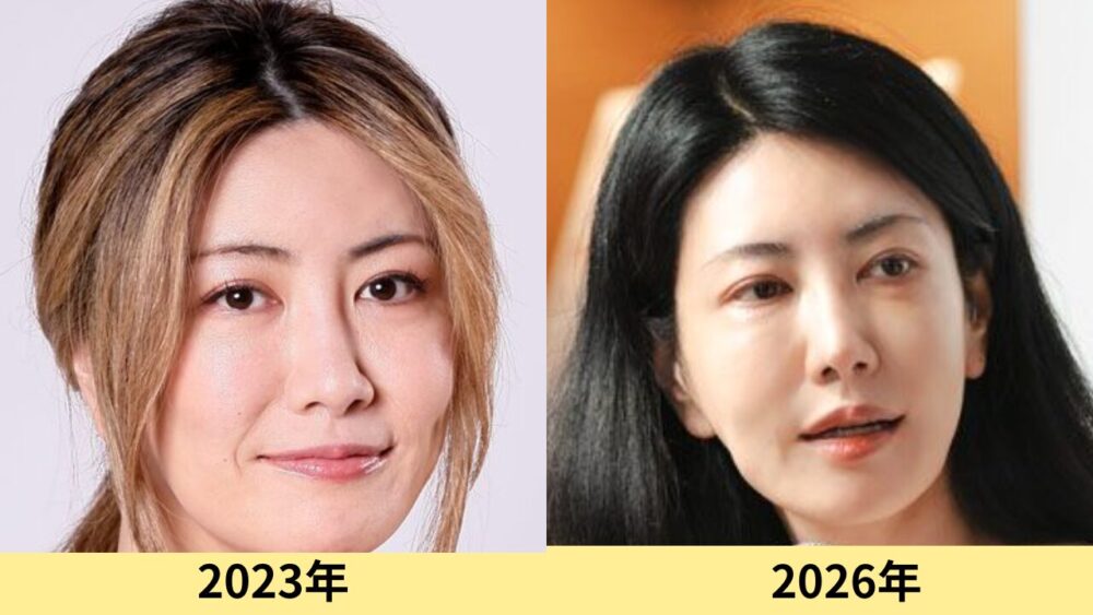 中野信子　顔変わった