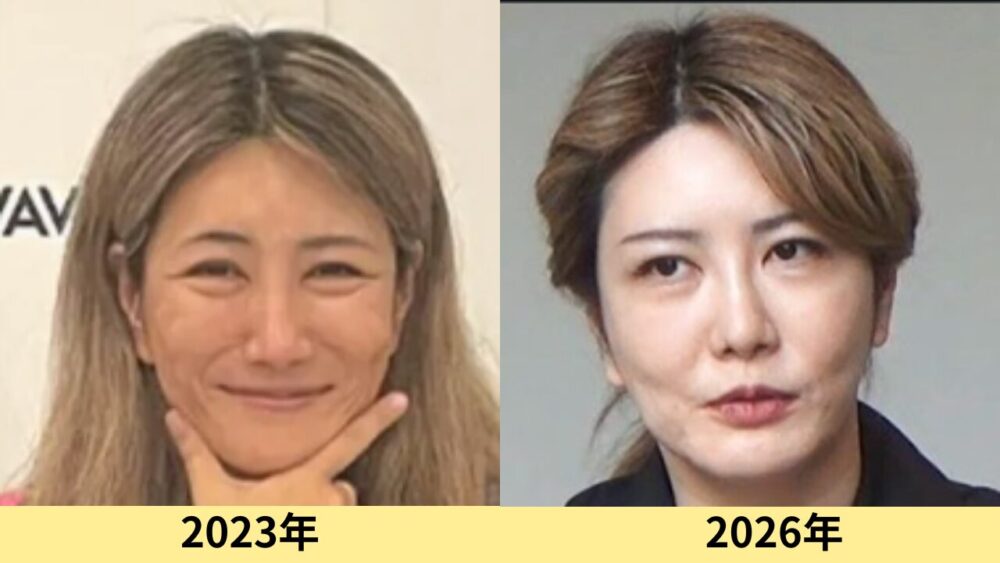 中野信子　顔変わった
