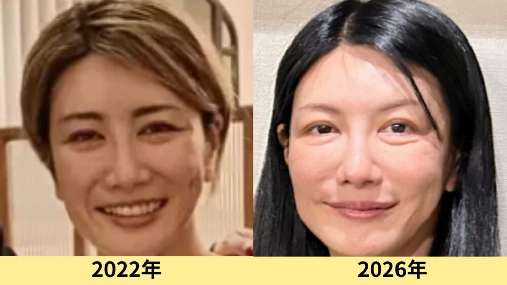 中野信子　顔変わった