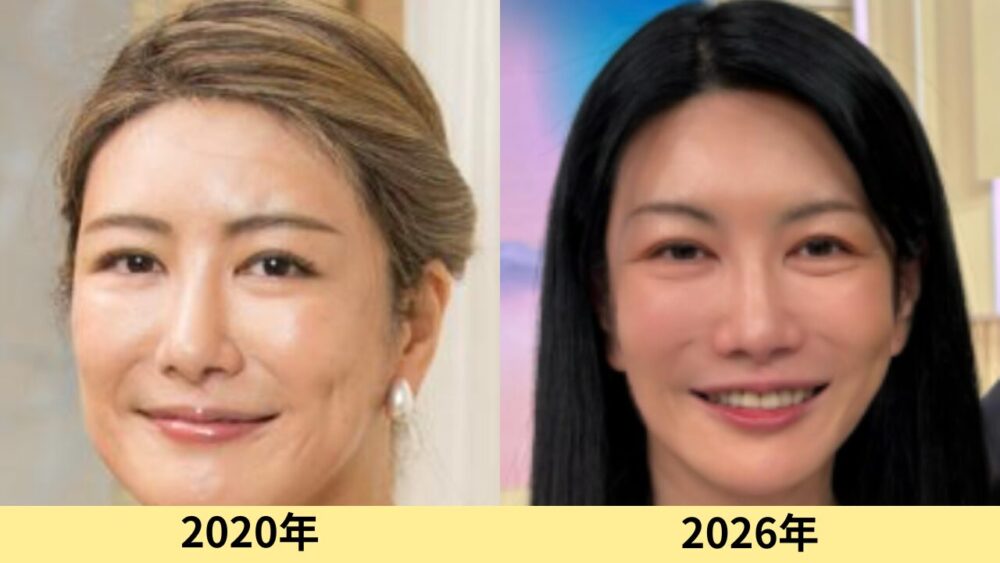 中野信子　顔変わった