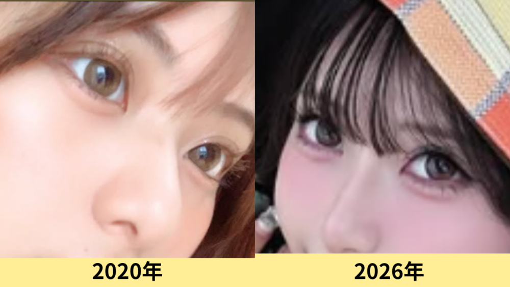 横田未来　顔変わった