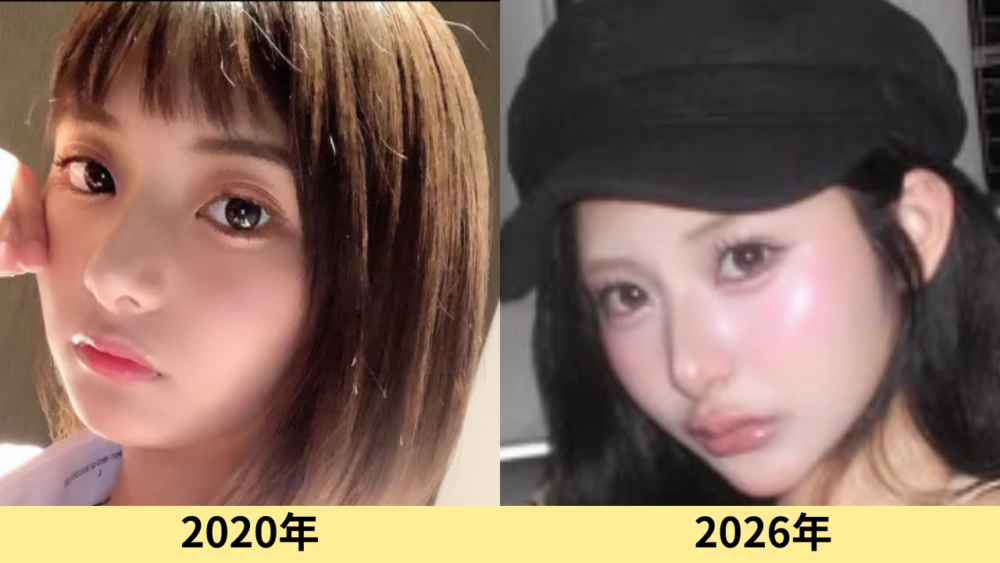 横田未来　顔変わった