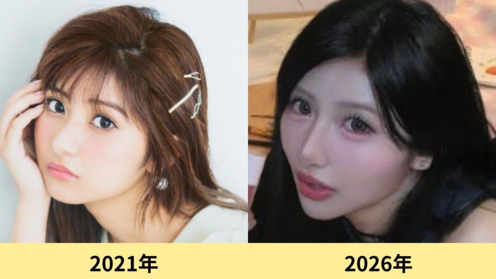 横田未来　顔変わった
