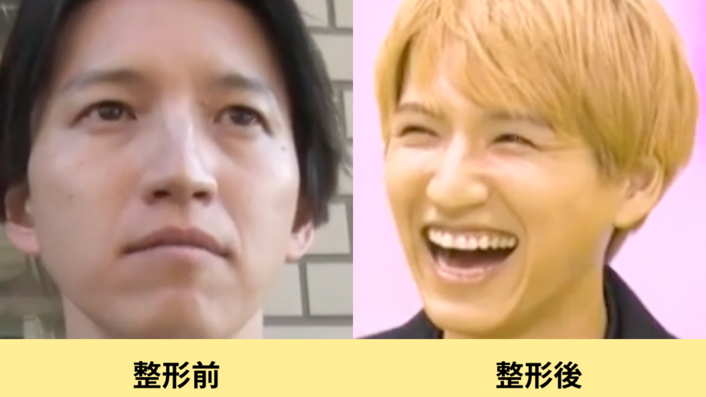 田口淳之介　顔変わった