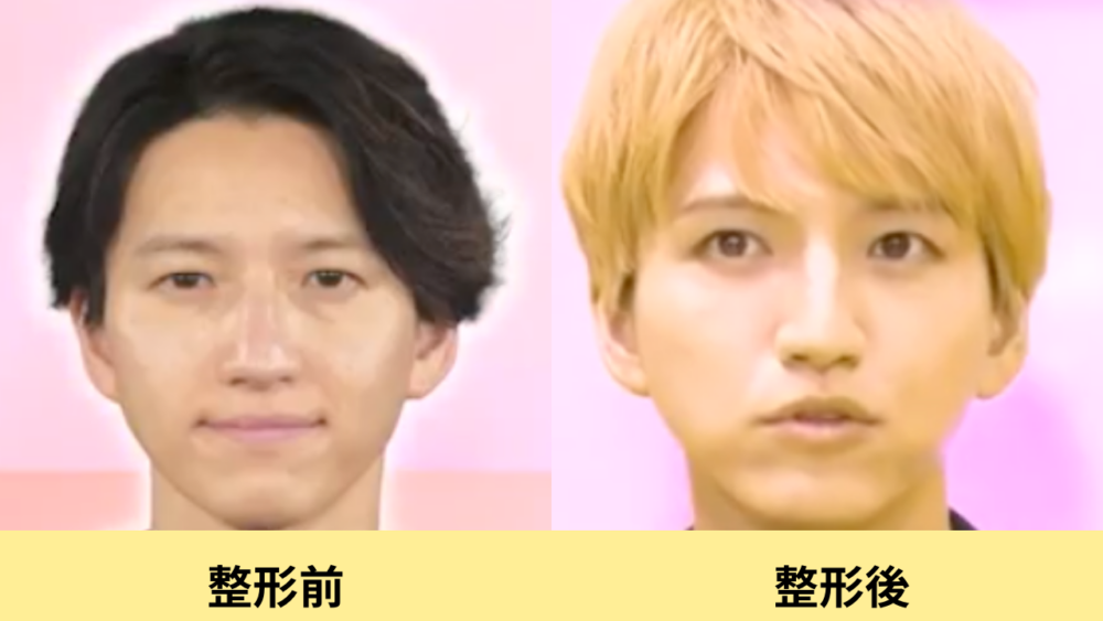 田口淳之介　顔変わった