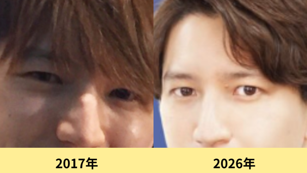 田口淳之介　顔変わった