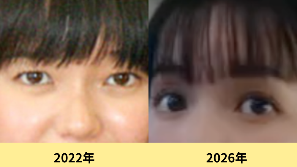 多部未華子　顔変わった
